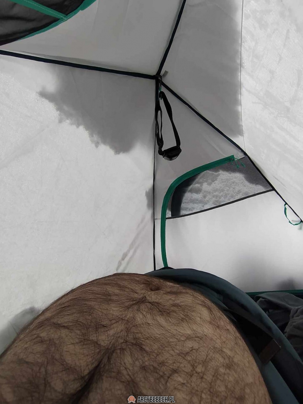 Chyba złamałem piszczel. To znaczy wczoraj przy ognisku